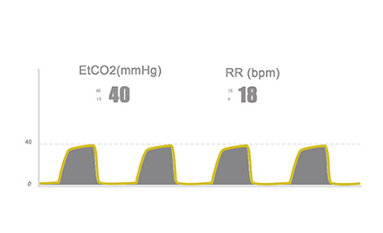 END TIDAL CO2 MONITORING
